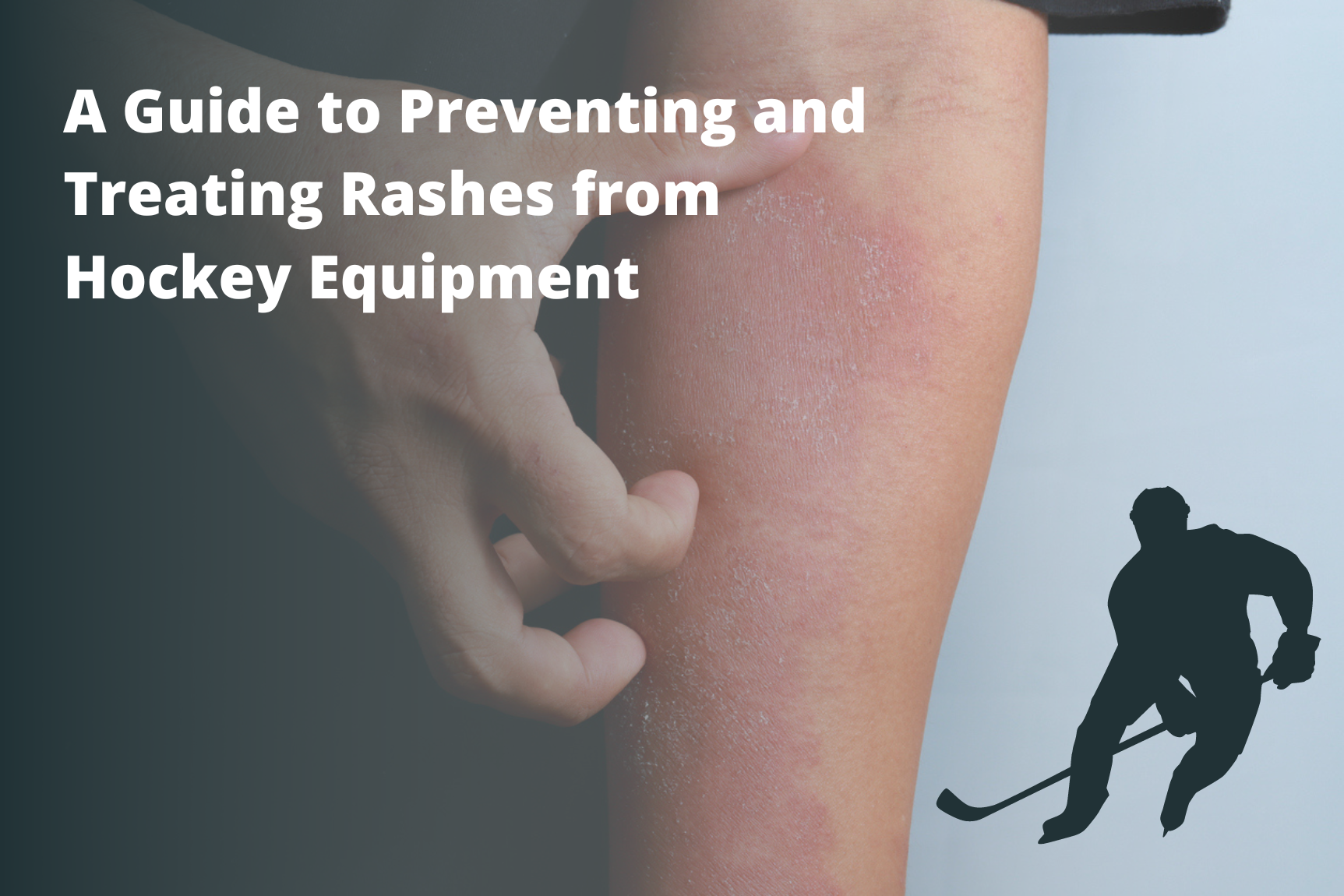 Gym Mat Rash Preventing & Treating a Rash From Hockey Equipment | Matguard