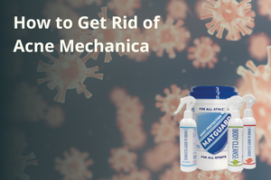 How to Get Rid of Acne Mechanica
