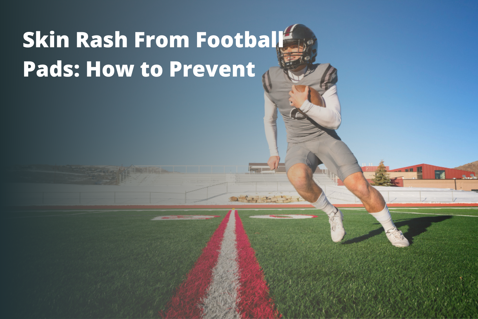 Skin Rash From Football Pads: How to Prevent