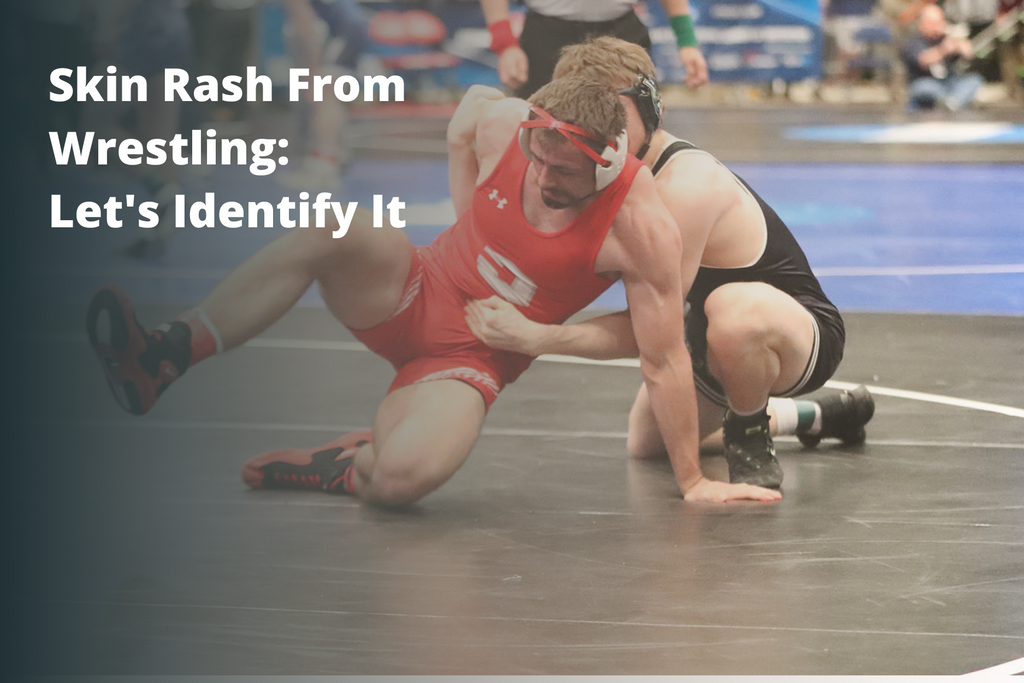 Skin Rash From Wrestling: Let's Identify It