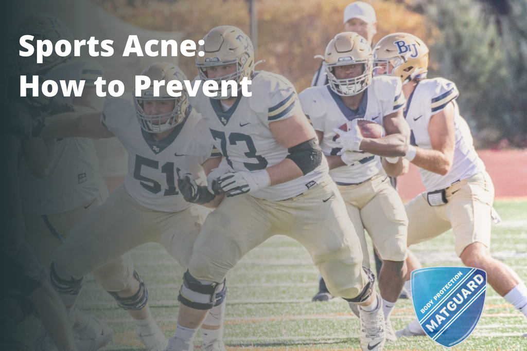 Preventing Helmet Acne: Tips for Athletes | Matguard USA Preventing Helmet Acne: Tips for Athletes | Matguard USA