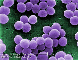 A High-Morbidity Outbreak of Methicillin-Resistant Staphylococcus aureus among Players on a College Football Team, Facilitated by Cosmetic Body Shaving and Turf Burns