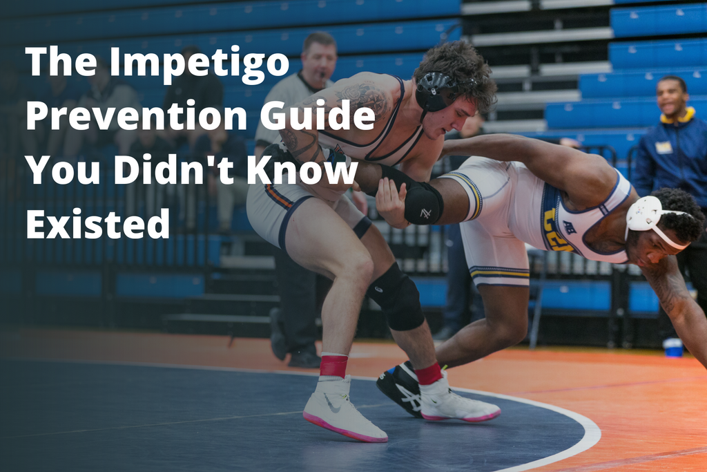 The Impetigo Prevention Guide You Didn't Know Existed