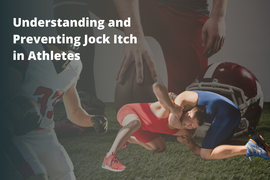 Understanding and Preventing Jock Itch in Athletes