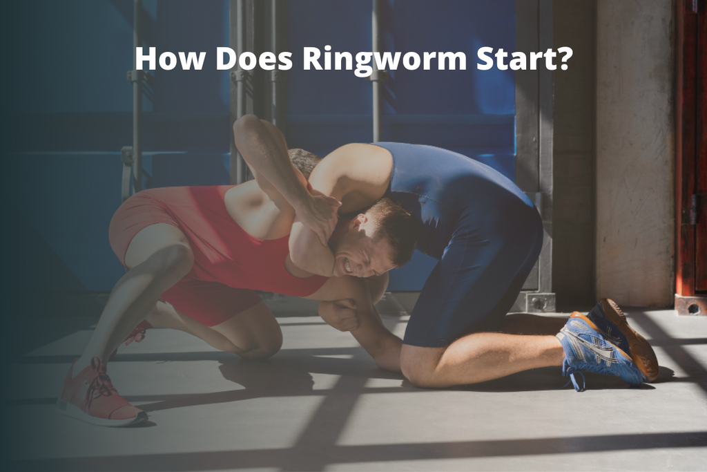 How Does Ringworm Start?