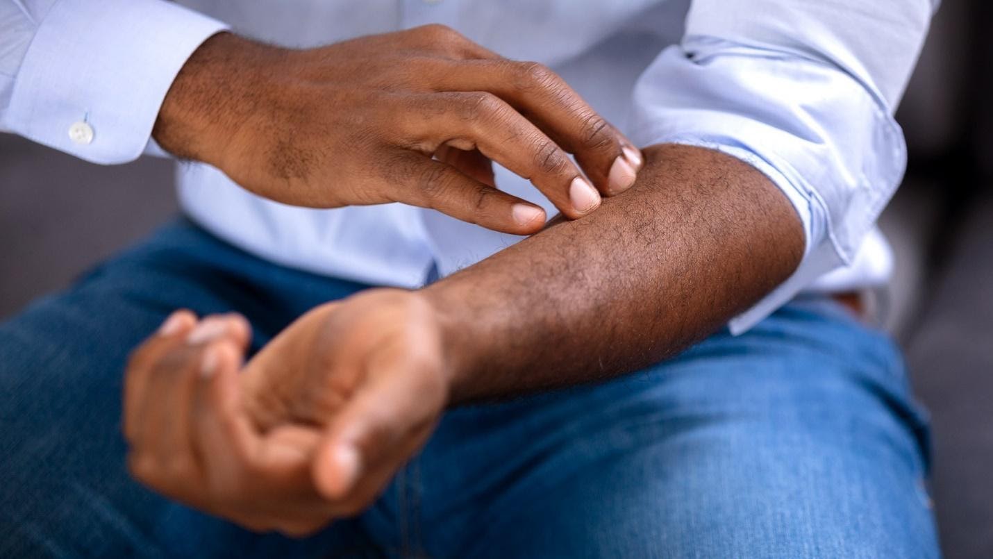 IS YOUR SANITIZER SKIN FRIENDLY AND EFFECTIVE? | Matguard
